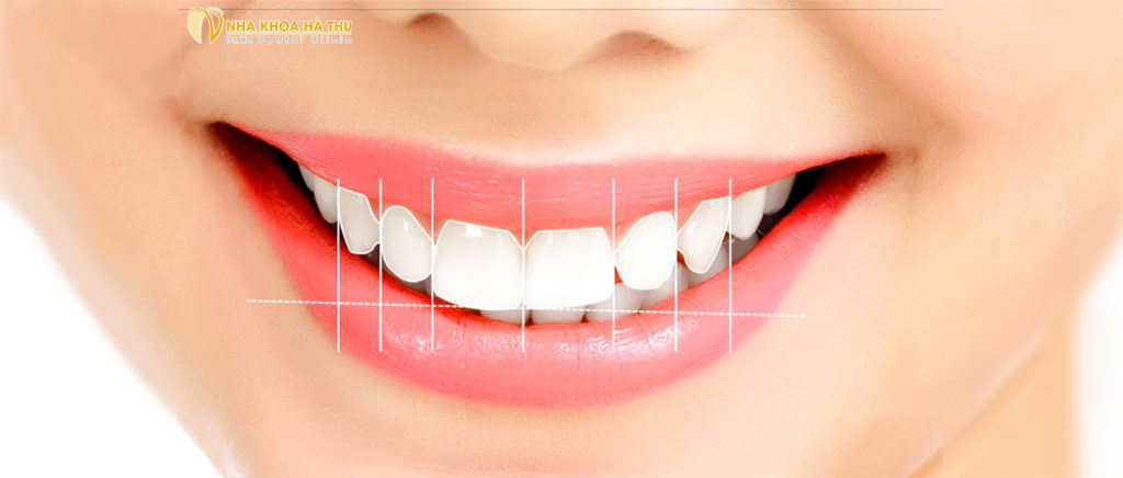 Hàm răng như mong ước: Đa giải pháp giúp răng đều như bắp