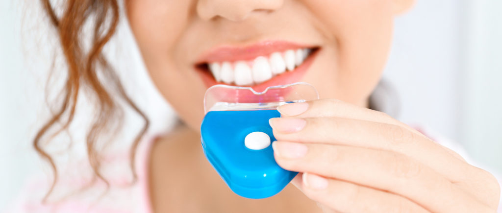 Tẩy trắng răng bật tone: Làm trắng răng xỉn màu crush mê