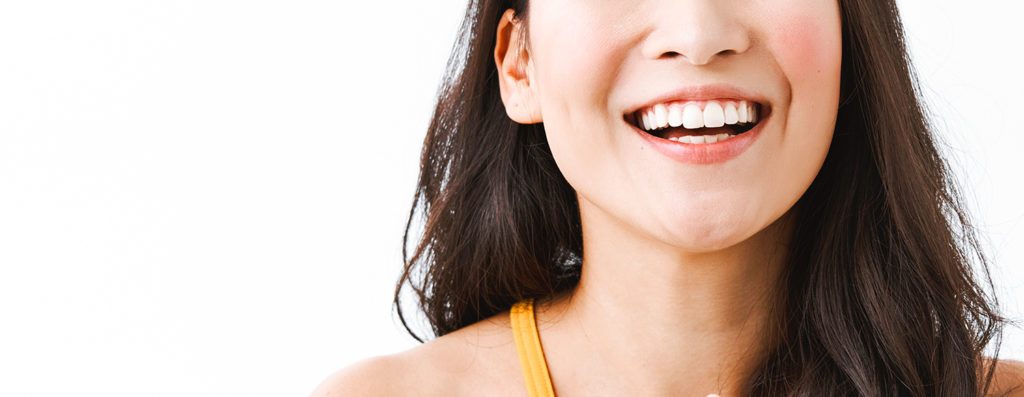 Tỏa sáng nhờ chỉnh răng: Yếu tố để có hàm răng đều đẹp