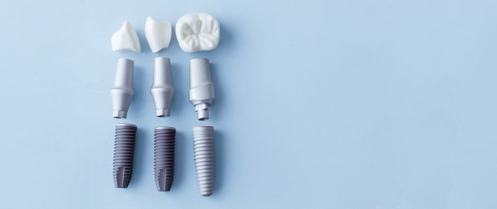 Phục hình răng implant: Xu thế Implant loại tốt nhất