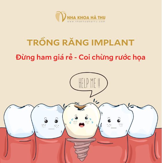 Implan giá rẻ - nguy hiểm khôn lường